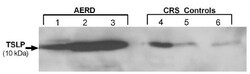 TSLP Antibody - BSA Free, Novus Biologicals 0.05mg; Unlabeled:Antibodies,
